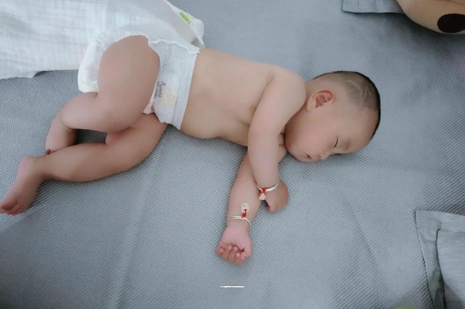 郑州六个月宝宝眼睛散光